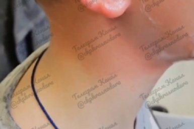 Подростки залили глаза из баллончика 11-летнему ребенку в Краснодаре скрин t.me/chpkrasnodara